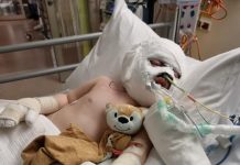 Community throws support behind two young Lancefield boys injured