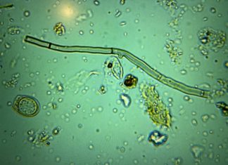 The Compost Conversation – Fungi, the quiet party guest